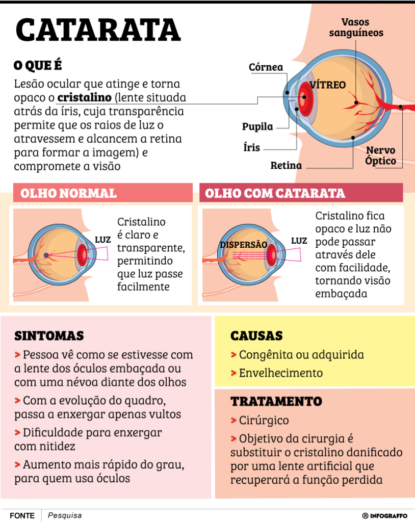 Abra os olhos para essas doenças que provocam cegueira