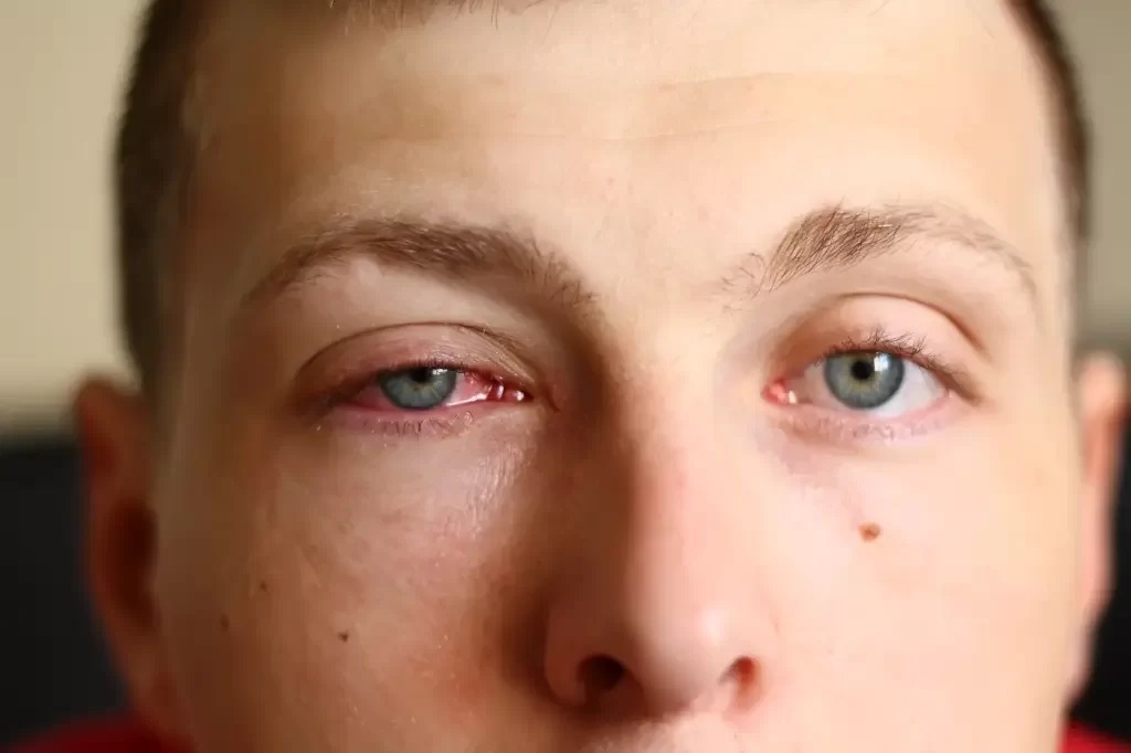 Sentindo seus olhos coçarem? Talvez este seja o motivo