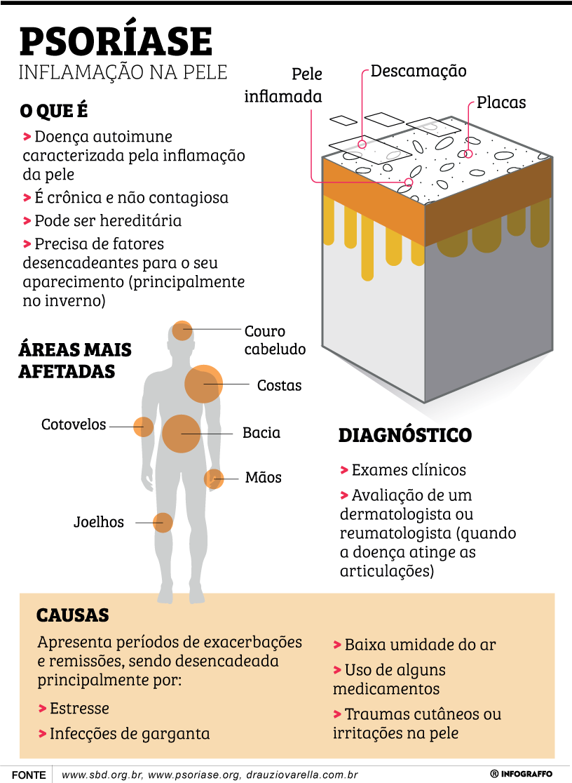 Psoríase