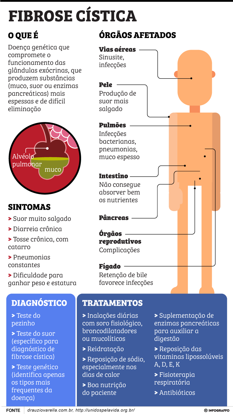 Fibrose Cística