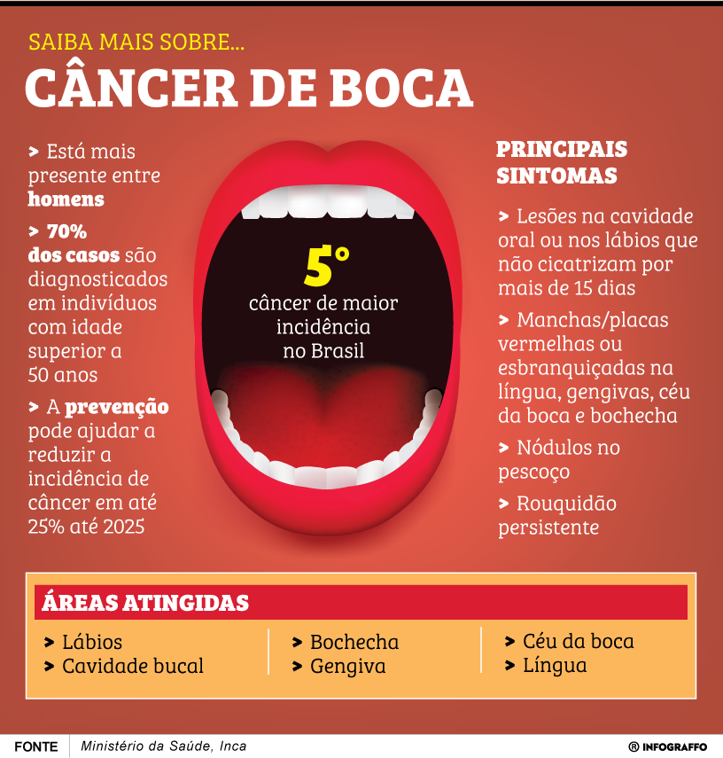 Câncer de boca