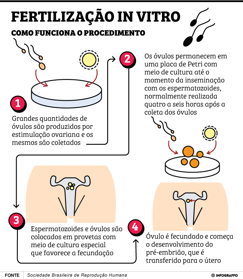 Fertilização In Vitro