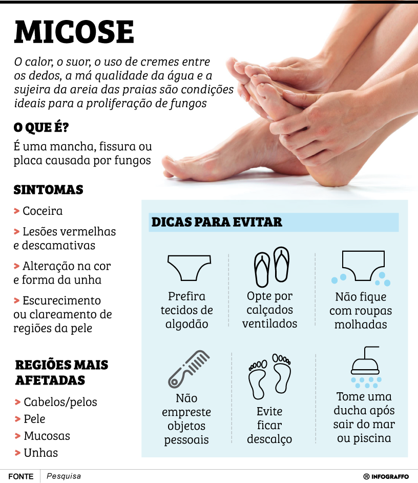 Micose