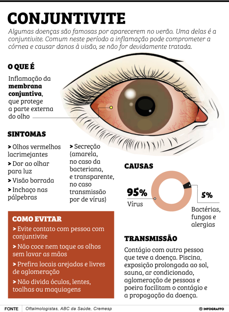 Conjuntivite