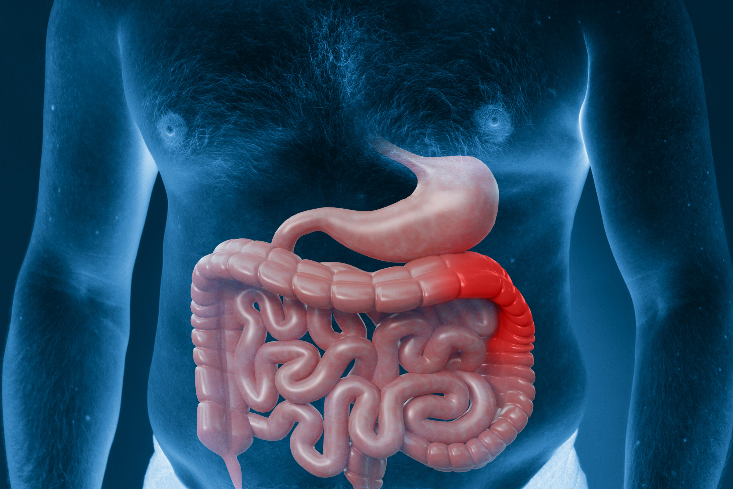 Março azul marinho alerta para prevenção do câncer de intestino